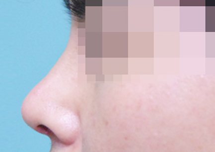 CASE 01 AFTER