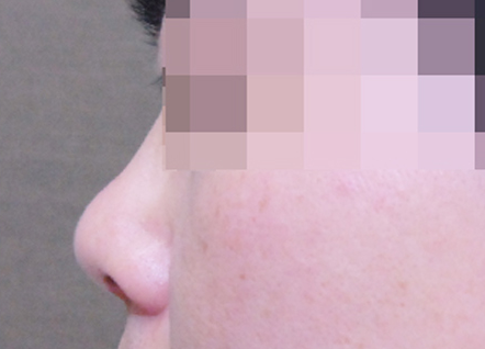 CASE 01 BEFORE