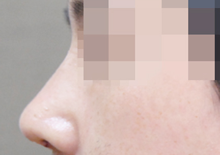 CASE 02 AFTER