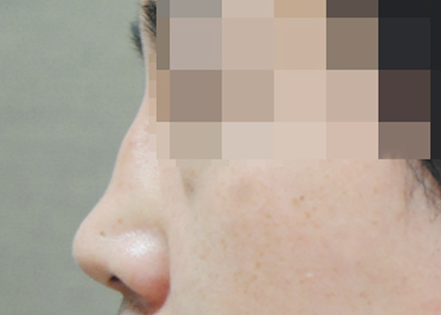CASE 02 BEFORE