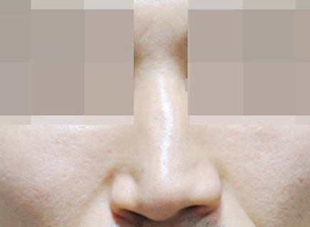 CASE 03 BEFORE